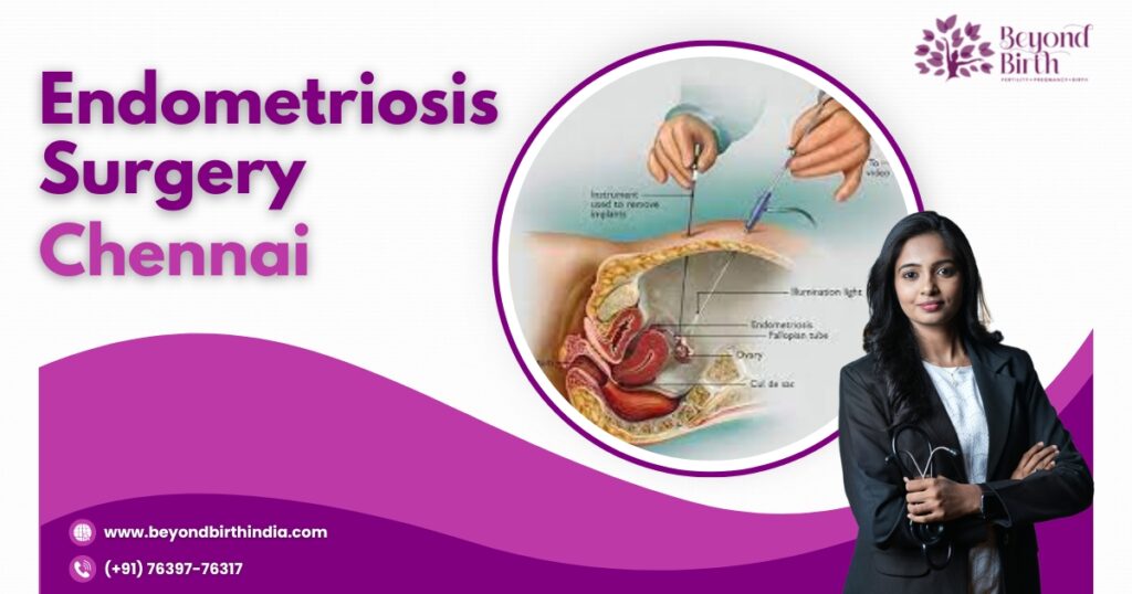 Visit Beyond Birth, Chennai, to get your Endometriosis Surgery done safely by the most experienced surgeons at the best price and ensure optimal recovery.