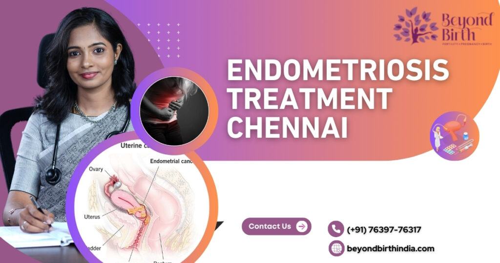 Beyond Birth offers top-notch uterine Endometriosis Treatment in Chennai, India, at an affordable price, backed by expert care. Contact us for details.