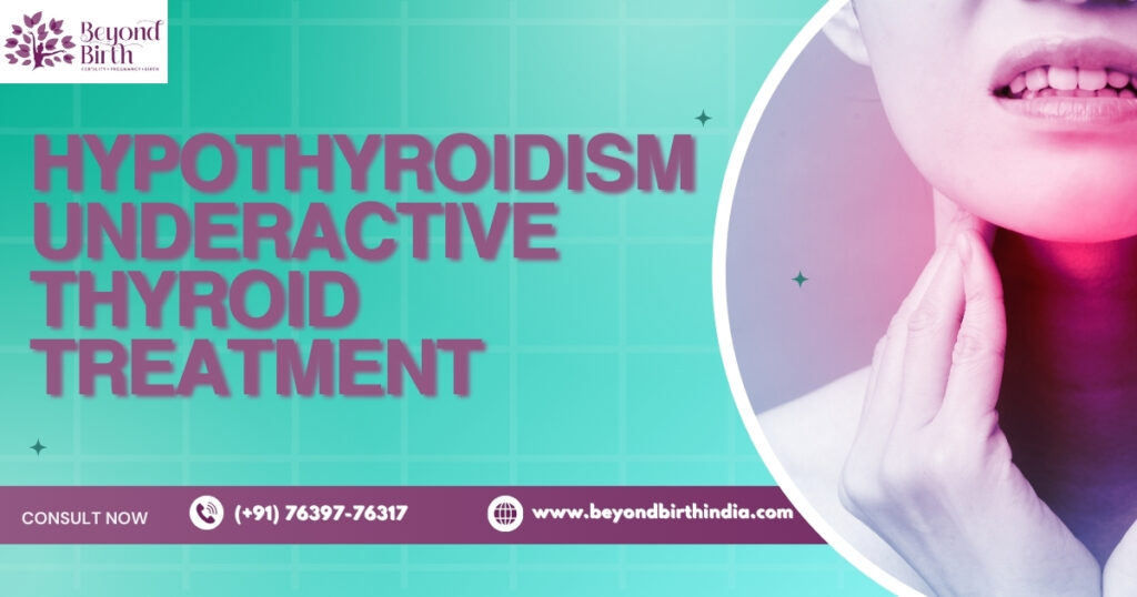 Hypothyroidism Underactive Thyroid Treatment - Beyond Birth